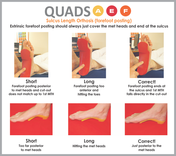 How to fit full length QUADRASTEP® orthotics from Nolaro24, LLC